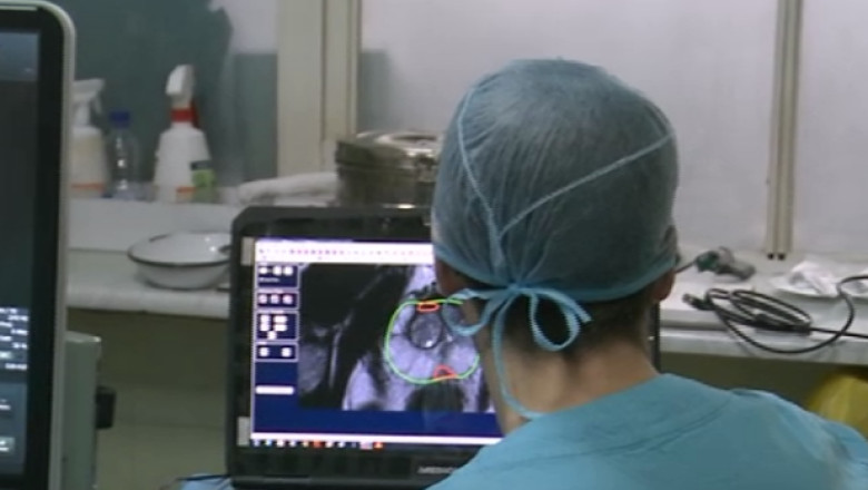 Premiera nationala: Metoda moderna de tratament pentru cancerul de prostata Imagine