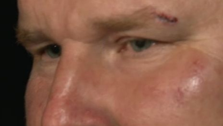 Primarul unei localitati din Constanta a fost batut de seful de post Imagine