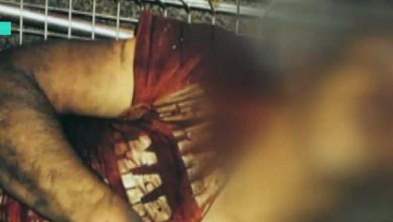 Primele fotografii cu adolescentul batut in Franta Imagine