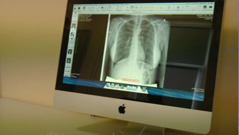 Primul aparat de radiologie 3D din sud-estul Europei, la Oradea Imagine