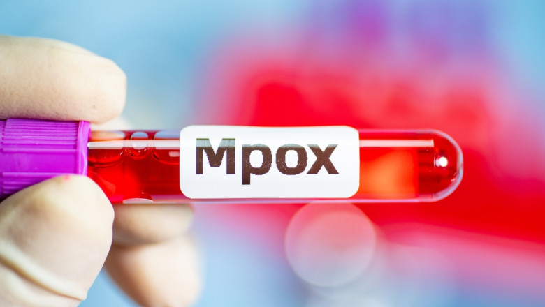 Primul caz de imbolnavire cu noua varianta mpox detectat in Franta Imagine