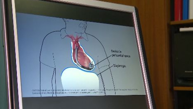 Primul implant de inima artificiala din Romania Imagine