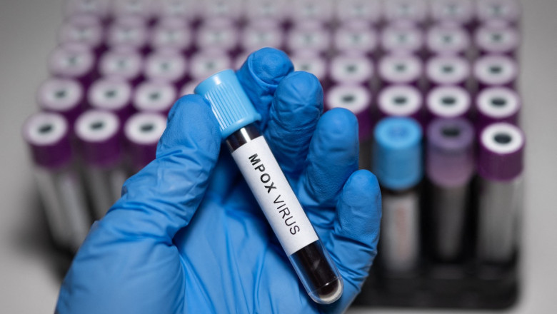 Primul test care poate detecta virusul mpox, cu rezultate imediate, a fost aprobat de OMS Imagine