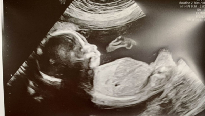 Procedurile de fertilizare in vitro vor fi decontate cu 15.000 de lei pe an. Cererile pot fi depuse online Imagine