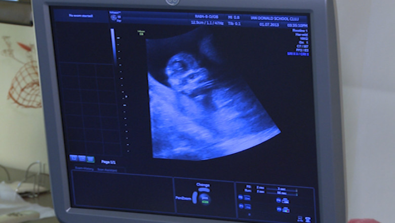 Proiect de milioane de euro pentru gravide Imagine