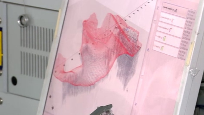 Proteze 3D. Cum sa porti un sold scos la imprimanta Imagine