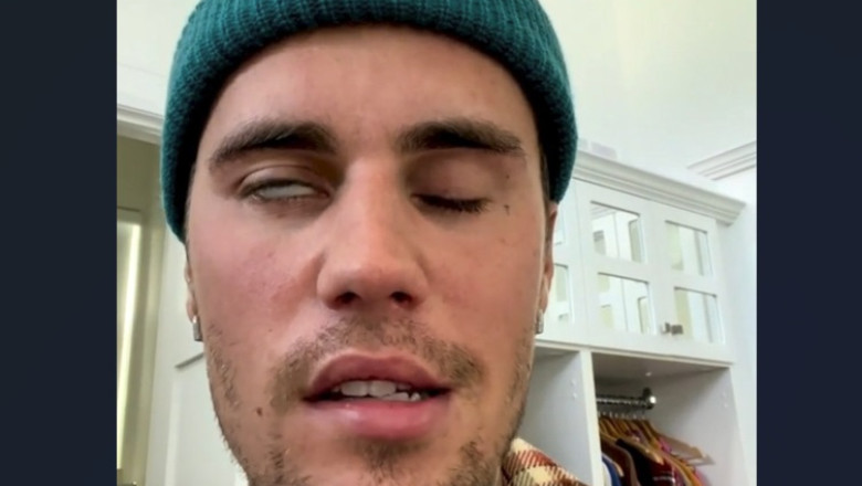 "Furtuna ingrozitoare cu care ma confrunt". Un nou mesaj al lui Bieber, la cateva zile dupa ce a aratat ca nu-si poate misca fata Imagine