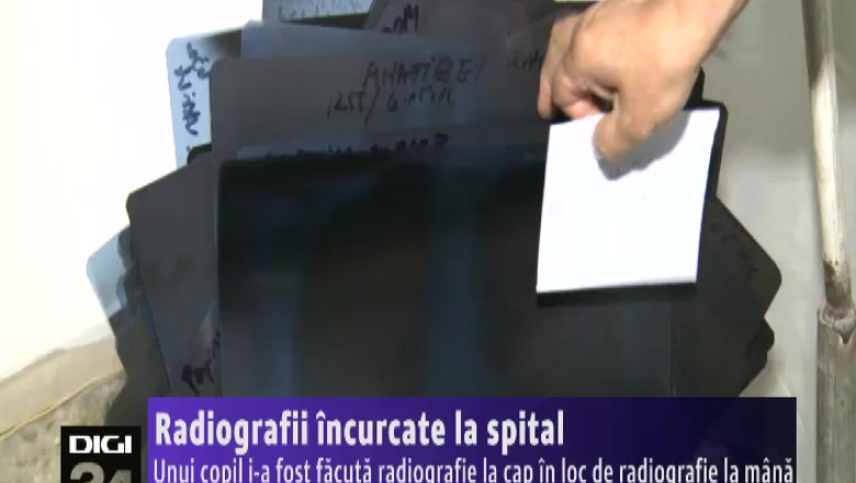 Radiografii incurcate la spital Imagine