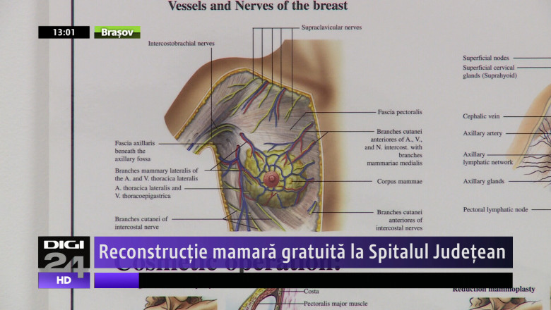 Reconstructie mamara gratuita la Spitalul Judetean Imagine