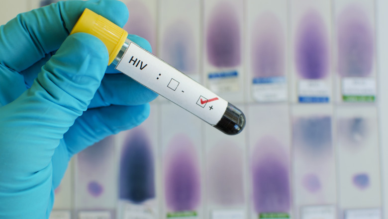 Revista Science a votat cea mai importanta descoperire stiintifica in 2024: Un medicament impotriva infectarii cu HIV Imagine