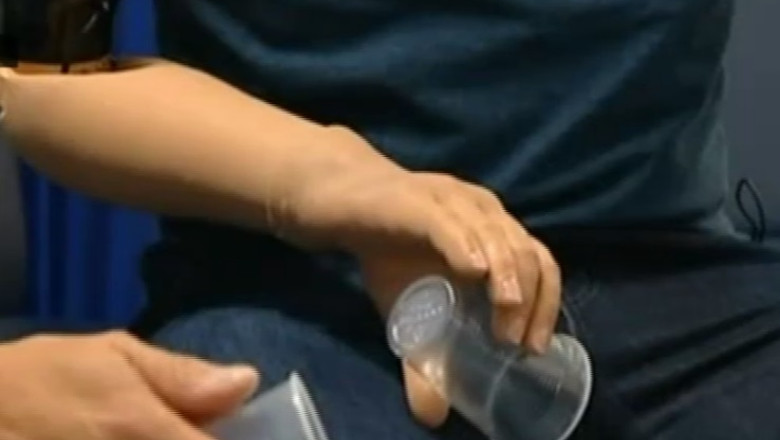 Revolutie in lumea medicala. Un britanic isi misca bratul artificial cu ajutorul creierului Imagine