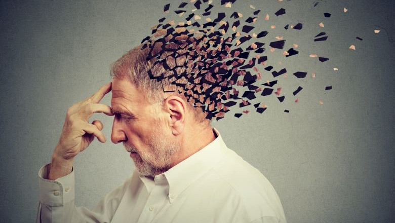 Rolul imagisticii prin rezonanta magnetica in diagnosticul bolii Alzheimer Imagine