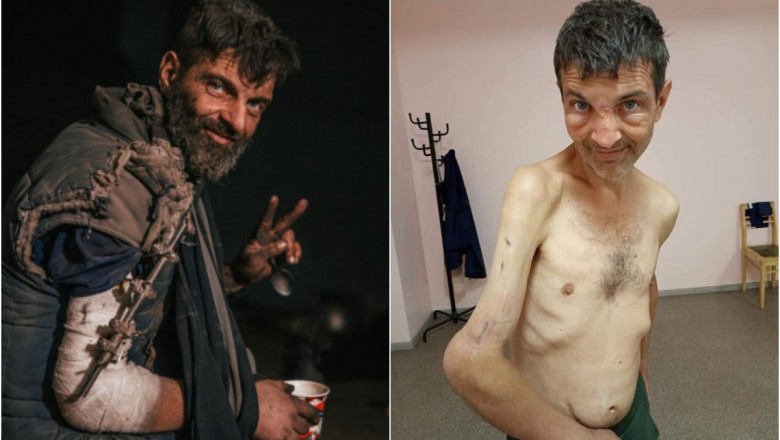 Rusii i-au smuls lui Mihailo cu clesti dispozitivul metalic care ii fixa bratul ranit. Sora luptatorului de la Azovstal face dezvaluiri Imagine