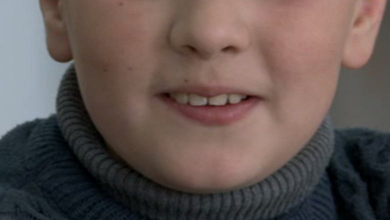 Statistici ingrijoratoare transmise de medicii stomatologi Imagine