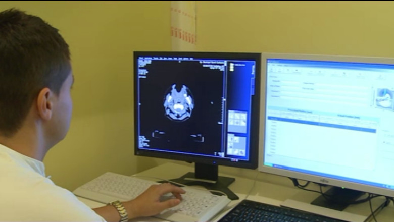 Studiu. Legatura dintre prajituri si Alzheimer  Imagine