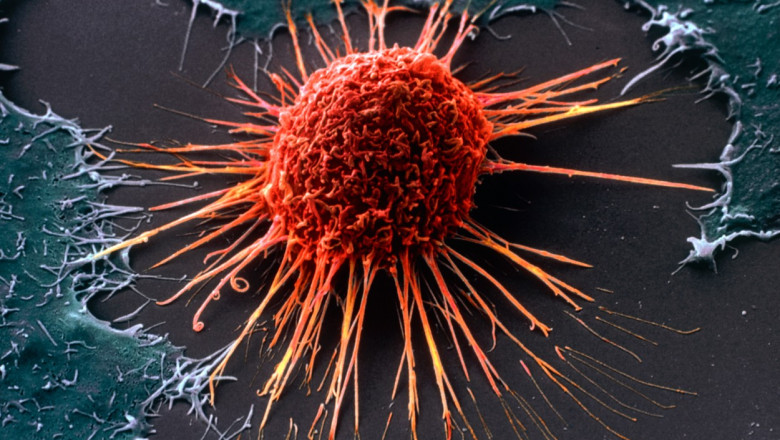STUDIU Un mecanism ascuns prin care sistemul imunitar poate lupta impotriva cancerului a fost descoperit Imagine