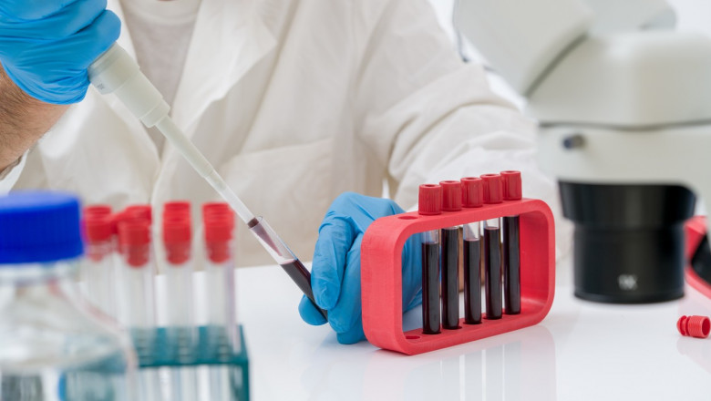STUDIU Un simplu test de sange poate detecta mai multe tipuri de cancer inainte de aparitia simptomelor Imagine