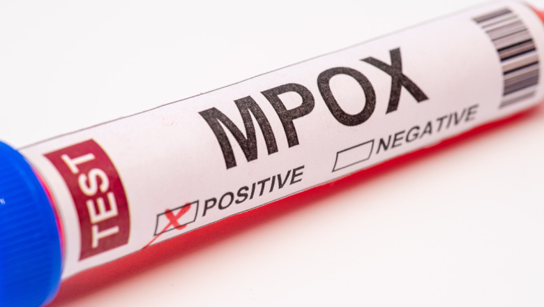 SUA confirma primul sau pacient cu noua forma de mpox Imagine