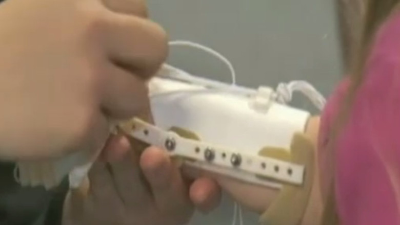 SUA. O fetita nascuta fara degete a primit in dar o mana robotica, realizata cu ajutorul unei imprimante 3D Imagine