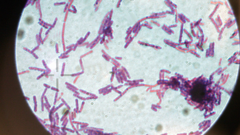 Suspiciune de antrax la doua persoane internate la Institutul National de Boli Infectioase „Matei Bals” din Bucuresti Imagine