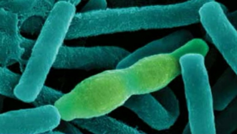 Suspiciuni de infectare cu antrax in Olt Imagine