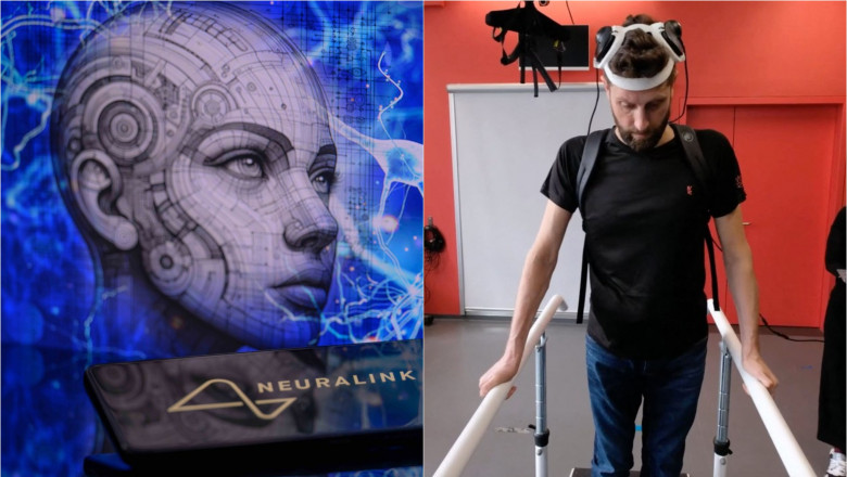 Tehnologia cipurilor implantate in creier a lui Elon Musk anunta inceputul erei cyborgilor Imagine