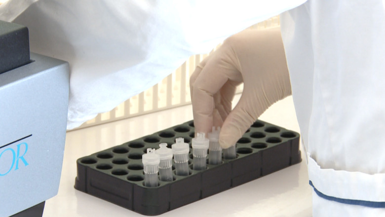 Teste gratuite pentru bolile infectioase, in centrele universitare Imagine