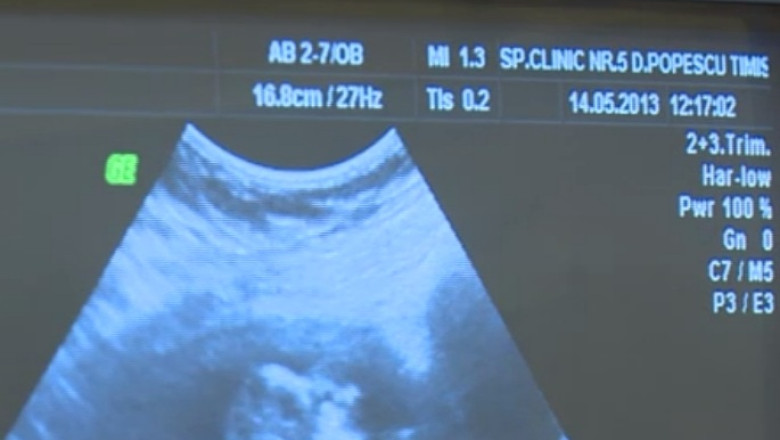 TIMISOARA. Specialisti din cinci tari ofera consultatii gratuite cu un ecograf performant Imagine