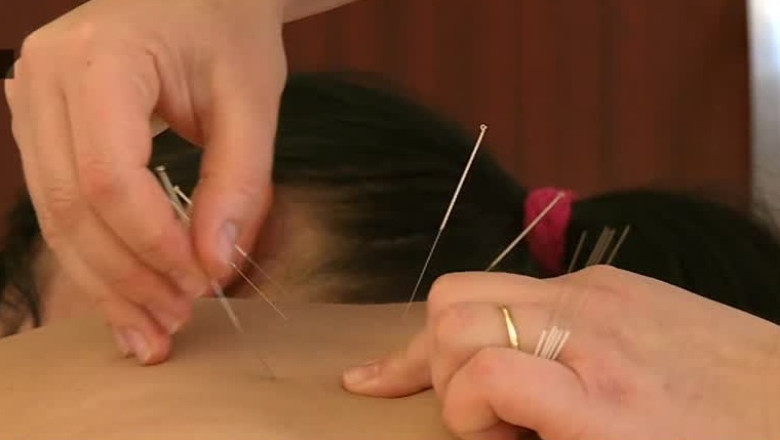 Toamna, anotimpul acupuncturii Imagine