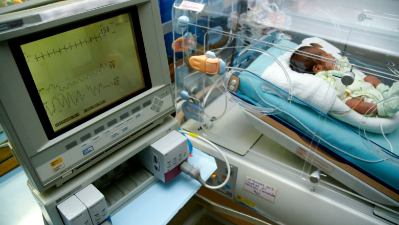 Tot mai multi copii se nasc cu malformatii. Medic: O mama mi-a spus ca a mancat chipsuri toata sarcina. Zilnic avem leucemii, tumori Imagine