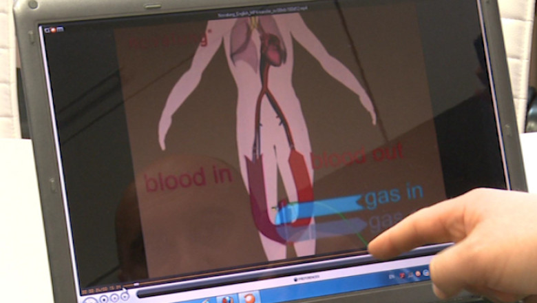 Transplantul de organe prinde viata Imagine