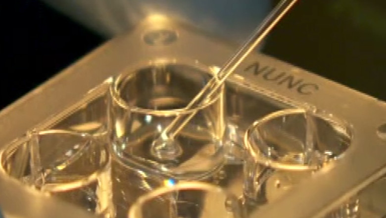 Tratament nou pentru infertilitate. Homeoterapia ginecologica ajuta corpul sa se vindece singur Imagine