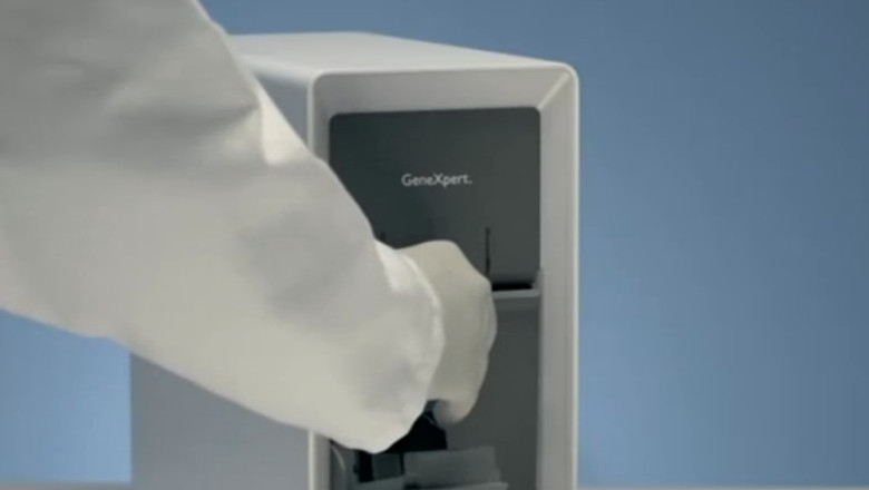 Tuberculoza, diagnosticata intr-o singura zi. Un ONG a donat medicilor doua aparate performante Imagine