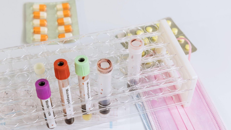 Un american aflat in vacanta in Mexic, care avea variola maimutei, a fugit din spital. Turistul calatorise inainte si in Europa Imagine