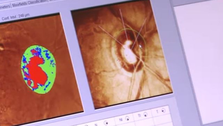 Un batran de 87 de ani din Dorohoi ar fi fost lasat sa moara pe patul de spital Imagine