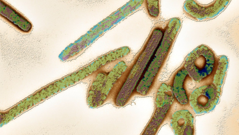 Un copil a murit dupa ce a fost infectat cu virusul Marburg, in Ghana Imagine