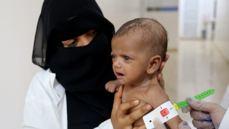 Un copil moare la fiecare 10 minute in Yemen. UNICEF cere ajutor urgent dupa ce tarile donatoare au promis doar 25% din banii necesari Imagine
