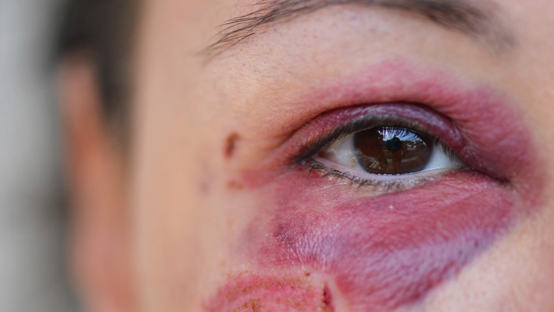 Un grup de ONG-uri romanesti sustine implementarea in regim de urgenta a ordinului de protectie Imagine