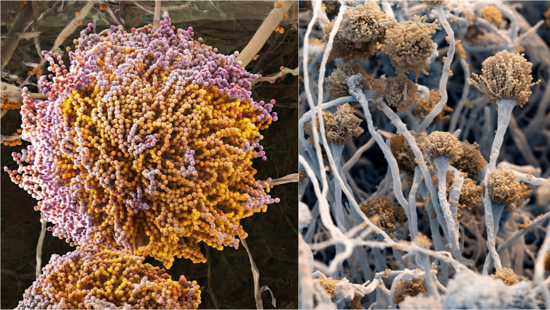 Un nou „supermicrob” ucigas ameninta planeta si se raspandeste intr-un ritm alarmant. De ce sunt infectiile fungice atat de periculoase Imagine