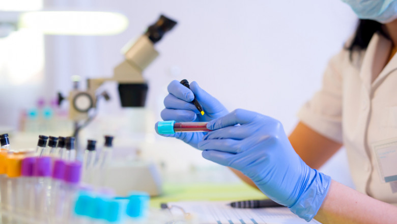 Un nou test de sange ar putea ajuta la identificarea riscurilor pentru sanatatea copiilor (studiu) Imagine