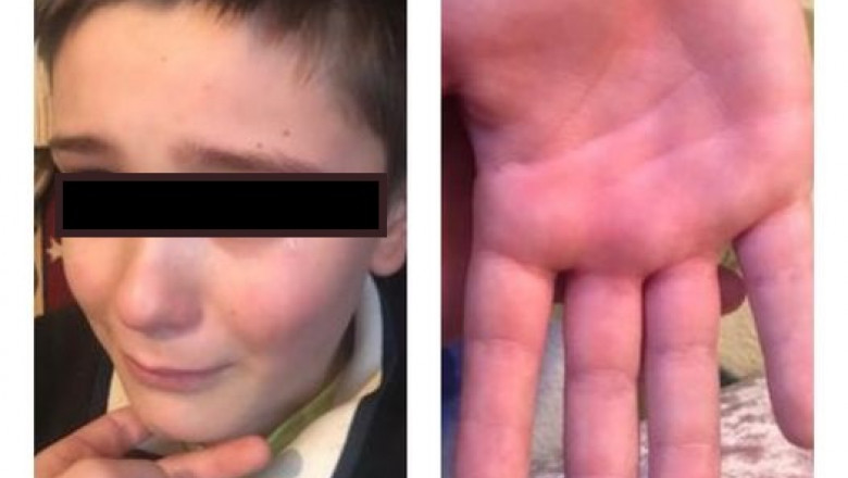 Un primar il lauda pe invatatorul care a batut un elev pentru ca nu stia tabla inmultirii. Firea cere sanctionarea lui Imagine