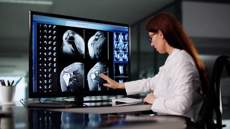 Un proiect urias de imagistica medicala va schimba felul in care bolile sunt depistate. Ce arata imaginile despre consumul de alcool Imagine