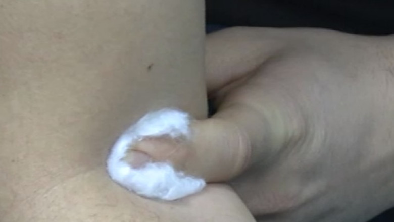 Un sofer baut a refuzat recoltarea de sange, motivand ca se teme de ace Imagine