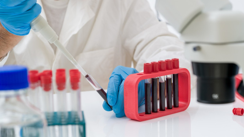 Un test de sange ar putea detecta prezenta mutatiilor maligne cu 3 ani inainte de aparitia primelor simptome de cancer, arata un studiu Imagine