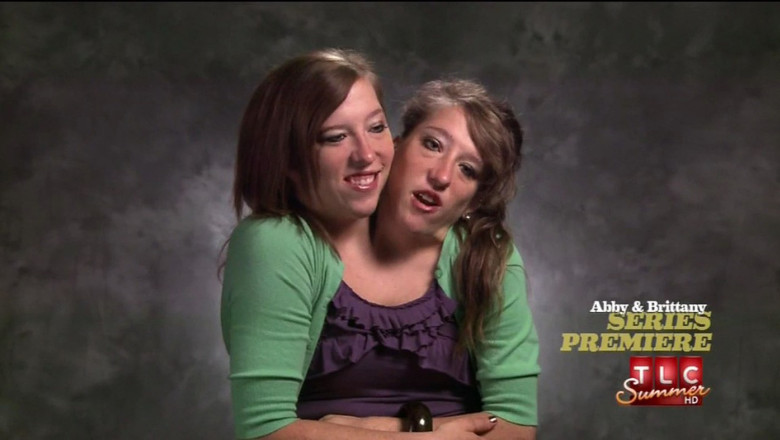 Una dintre celebrele gemene siameze Abby si Brittany s-a casatorit. De ce nu au facut niciodata operatia de separare Imagine