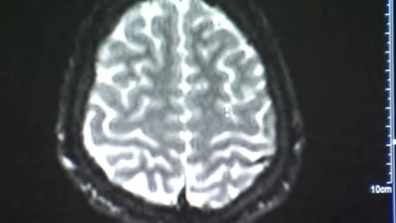 Varsta din buletin, diferita de cea a organismului. Care este varsta creierului tau Imagine