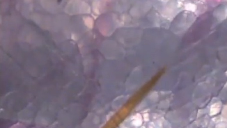 VIDEO. Cum se vede la microscop intepatura unui tantar Imagine