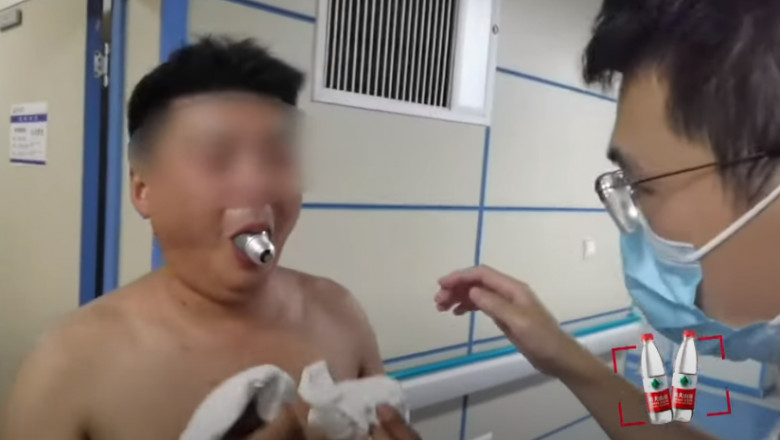 VIDEO. Un barbat a ajuns la urgente cu un bec blocat in gura, dupa ce a vazut o provocare online si s-a gandit sa o incerce si el Imagine