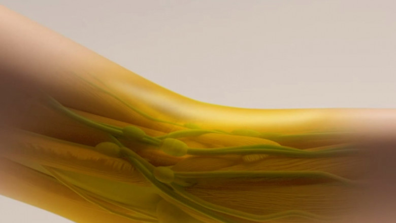 VIDEO. Un colorant alimentar face pielea invizibila. Vor putea sa vada organele afectate fara sa apeleze la tehnicile clasice Imagine