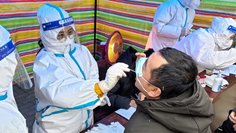 Zeci de persoane s-au infectat cu un nou virus aparut in China si transmis de la animale. Virusul poate afecta ficatul si rinichii Imagine